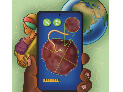 Placenta assessment tool aims to improve neonatal, maternal care | Penn State University
